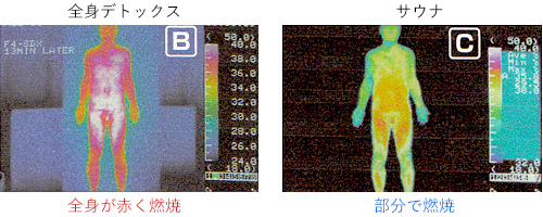 全身デトックスとサウナのちがい